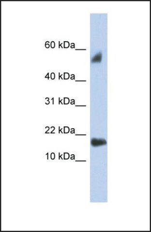 Anti-FLJ35767 antibody produced in rabbit