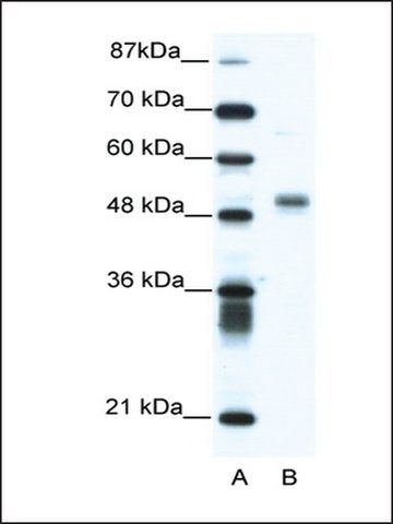 Anti-FLI1 antibody produced in rabbit