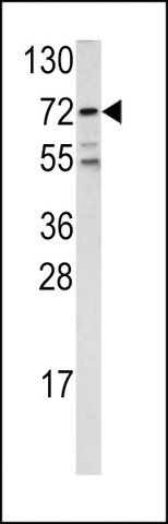 ANTI-FKHR (CENTER D469) antibody produced in rabbit