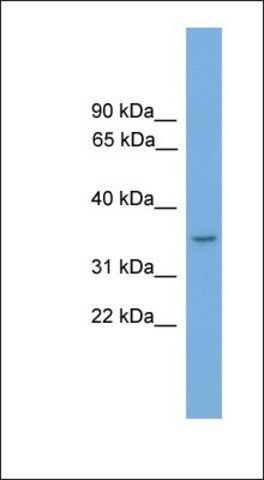 Anti-FLJ36070 antibody produced in rabbit