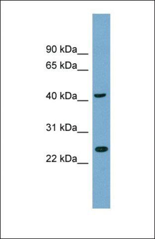 Anti-FLJ25439, (N-terminal) antibody produced in rabbit