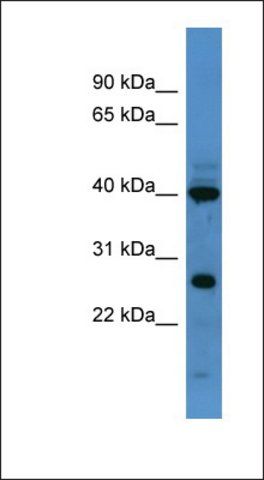 Anti-FOXL2 antibody produced in rabbit