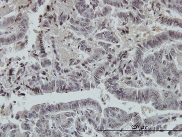 ANTI-FOXO3A antibody produced in mouse