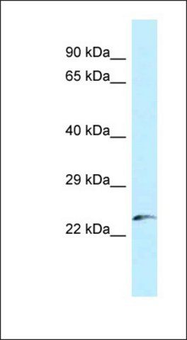 Anti-FLJ43806 antibody produced in rabbit