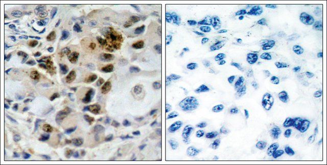 Anti-FOXO4 (Ab-197) antibody produced in rabbit