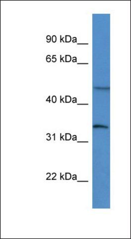 Anti-FOXL2 antibody produced in rabbit