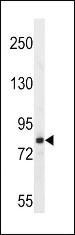 ANTI-FSCB (C-TERM) antibody produced in rabbit