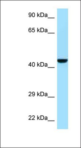 Anti-GMPPB antibody produced in rabbit