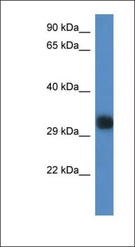 Anti-GM527 antibody produced in rabbit