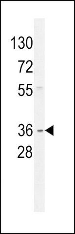 ANTI-GNAT3 (CENTER) antibody produced in rabbit