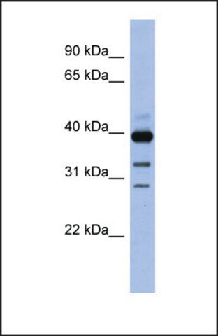 Anti-GNAO1, (N-terminal) antibody produced in rabbit