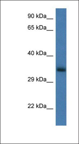 Anti-GNPDA1 antibody produced in rabbit