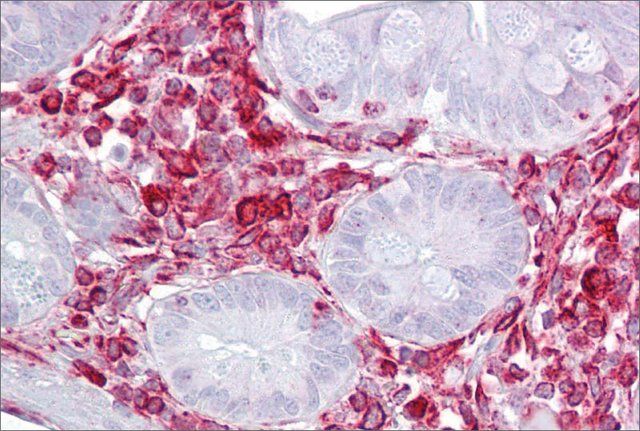 Anti-GNB2L1, (N-terminal) antibody produced in rabbit