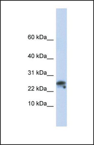 Anti-GNLY, (N-terminal) antibody produced in rabbit