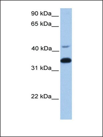 Anti-GNB2 antibody produced in rabbit