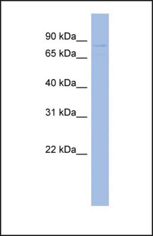 Anti-GPD2, (N-terminal) antibody produced in rabbit