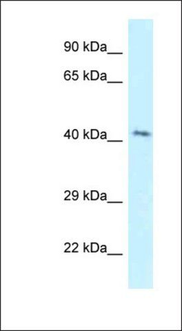 Anti-GPER antibody produced in rabbit