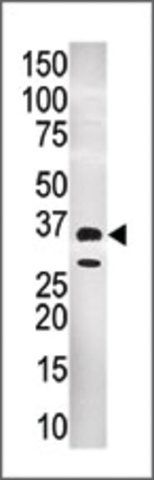 Anti-GNMT (C-term) antibody produced in rabbit