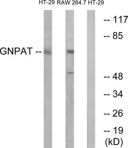 Anti-GNPAT antibody produced in rabbit