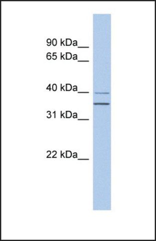 Anti-GNAQ, (N-terminal) antibody produced in rabbit