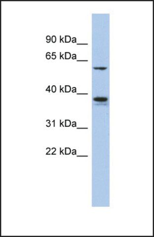 Anti-GOPC antibody produced in rabbit