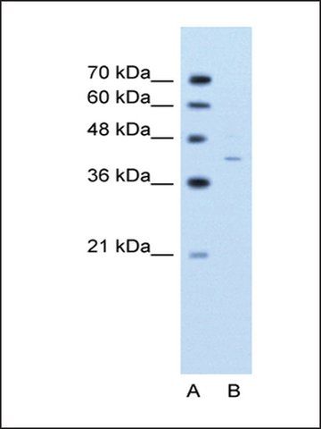 Anti-GNAS (AB2) antibody produced in rabbit