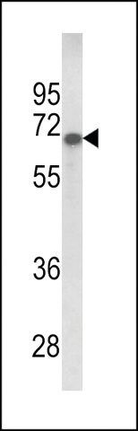 ANTI-GPC4 (CENTER) antibody produced in rabbit