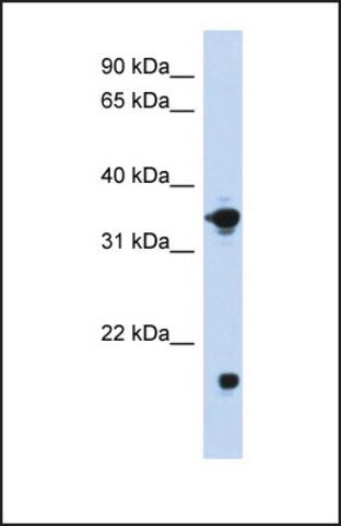 Anti-GPD1 antibody produced in rabbit