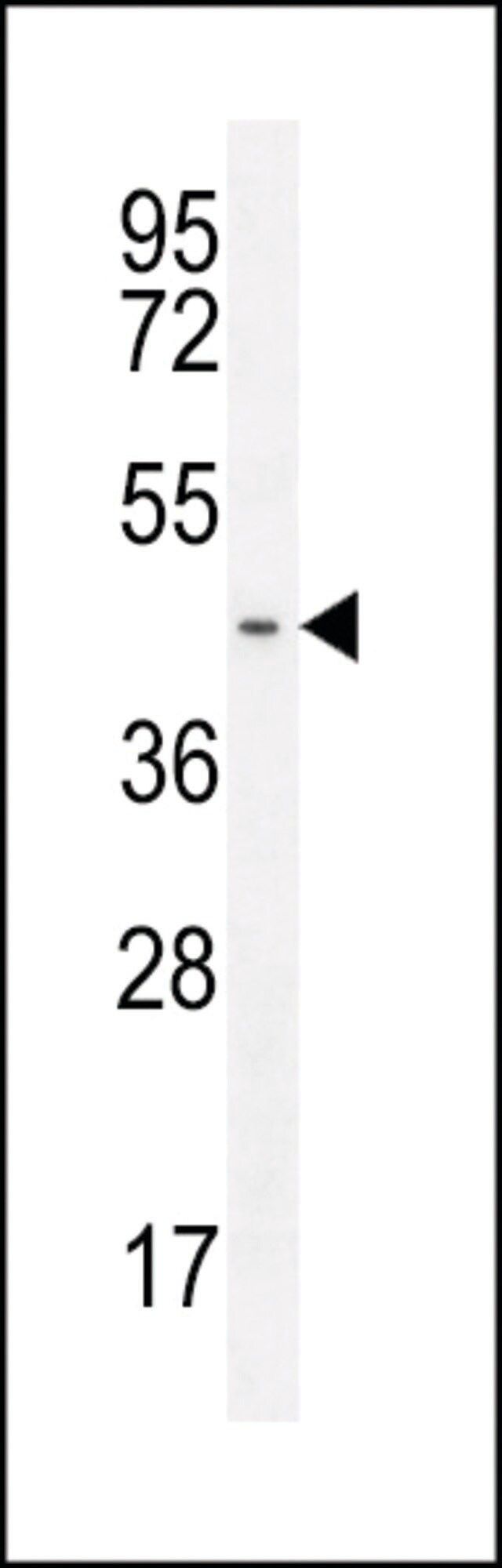 ANTI-GPR142(N-TERMINAL) antibody produced in rabbit