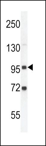 ANTI-GPLD1(C-TERMINAL) antibody produced in rabbit