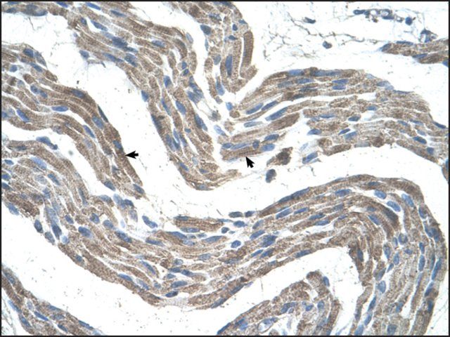 Anti-GPR161 (AB2) antibody produced in rabbit