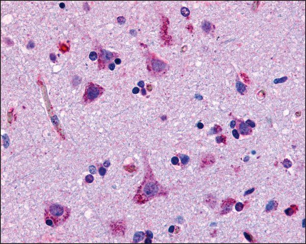 Anti-GPR45 antibody produced in rabbit