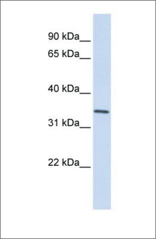 Anti-GNPDA1 antibody produced in rabbit