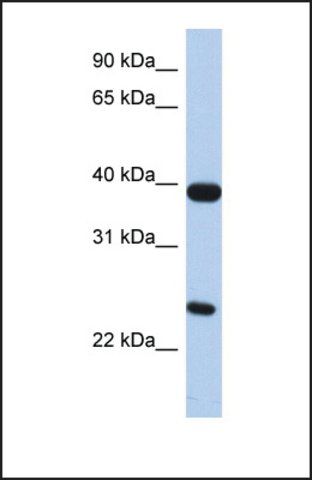 Anti-GPR15, (N-terminal) antibody produced in rabbit