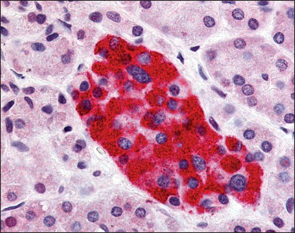 Anti-GPR55 antibody produced in rabbit