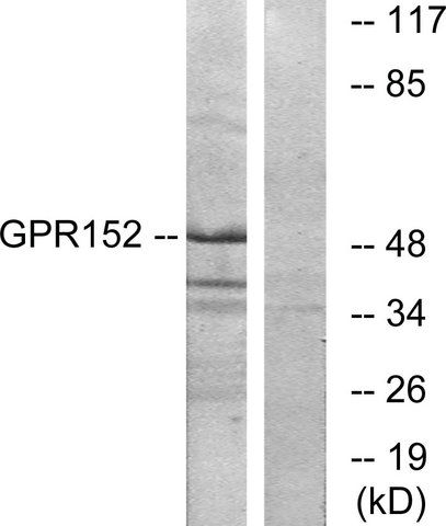 Anti-GPR152 antibody produced in rabbit