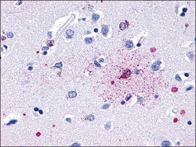 Anti-GPR139 antibody produced in rabbit