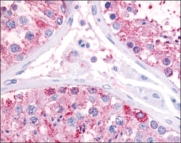 Anti-GPR22 antibody produced in rabbit