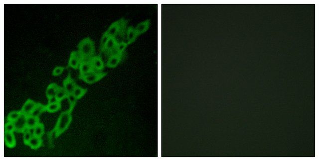 Anti-GPR32 antibody produced in rabbit