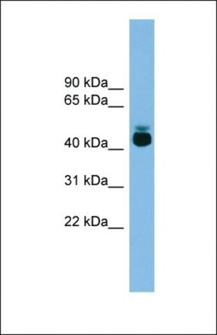 Anti-GPR87 antibody produced in rabbit