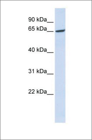 Anti-GPR177 antibody produced in rabbit