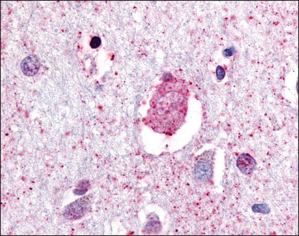 Anti-GPR88 antibody produced in rabbit