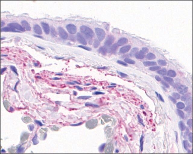 Anti-GPR4 antibody produced in rabbit