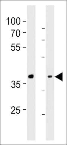 ANTI-GPR4 (CENTER) antibody produced in rabbit