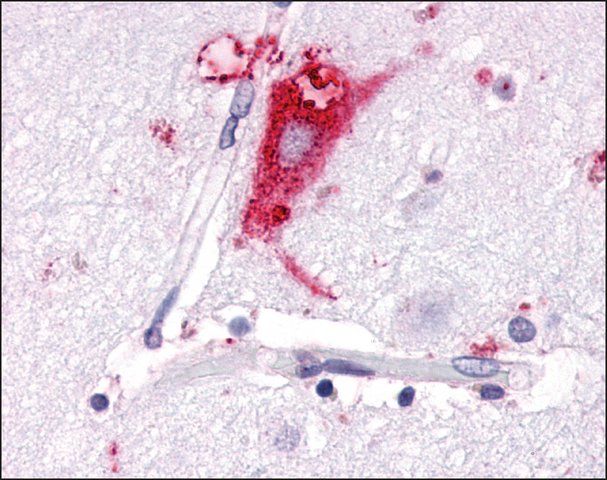 Anti-GPR63 antibody produced in rabbit