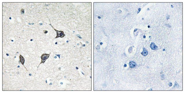 Anti-GPR20 antibody produced in rabbit