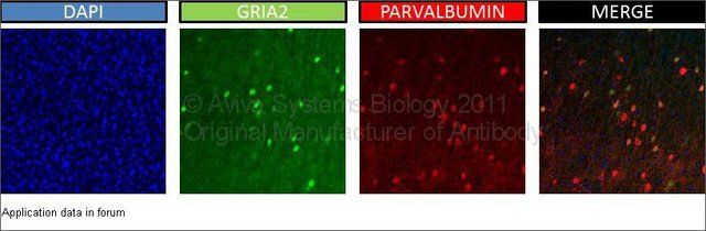 Anti-GRIA2 (AB1) antibody produced in rabbit