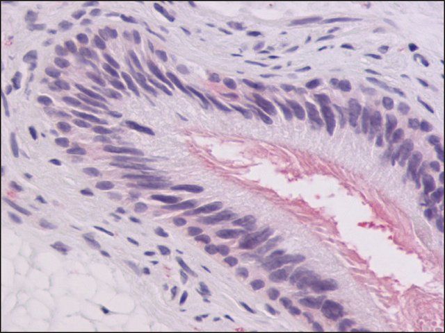 Anti-GPR64 antibody produced in rabbit