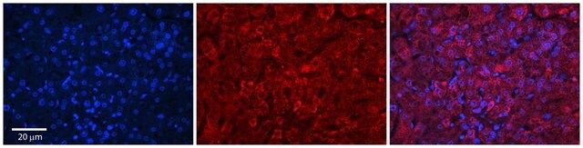 Anti-GRHPR antibody produced in rabbit