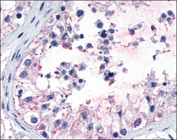 Anti-GPR149 antibody produced in rabbit